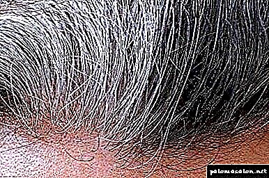7 xeitos de desfacerse do pelo gris para sempre