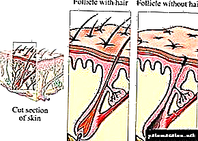 Amayambitsa komanso amathandizira autoimmune alopecia (tsitsi lotayika)