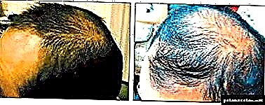 თმის პრობლემები? სრულად - restoration1 წამალია თმის აღდგენისთვის