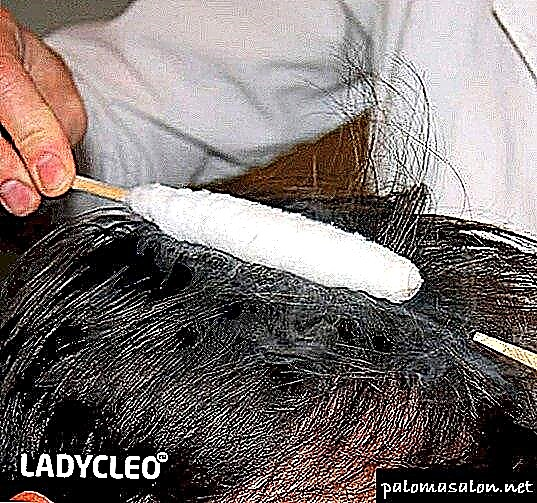 A crioterapia como método de tratamento do coiro cabeludo
