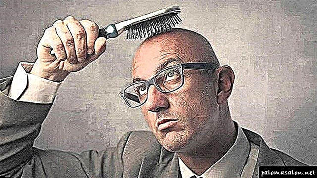 کاشت مو: هر آنچه را که باید در مورد روش بدانید
